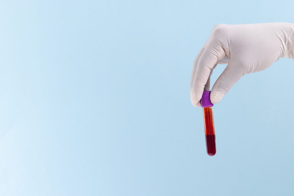 A hand holding a blood test tube on a blue background.